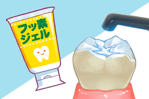小児歯科で具体的に行う治療とは